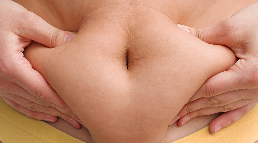 mage med overflødig hud før bukplastikk